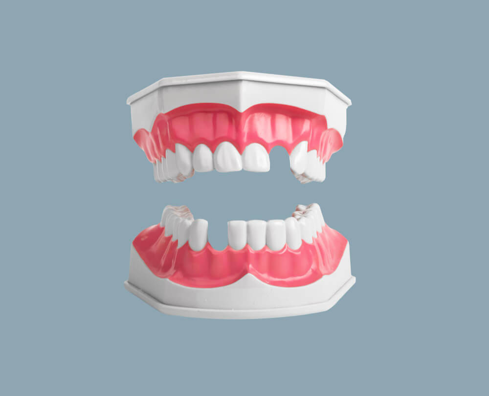 dentista 3d blog madrid dental