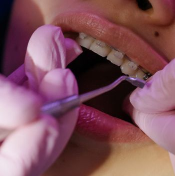 estetica dental imagen tratamiento (1)