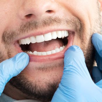 estetica dental imagen tratamiento (3)