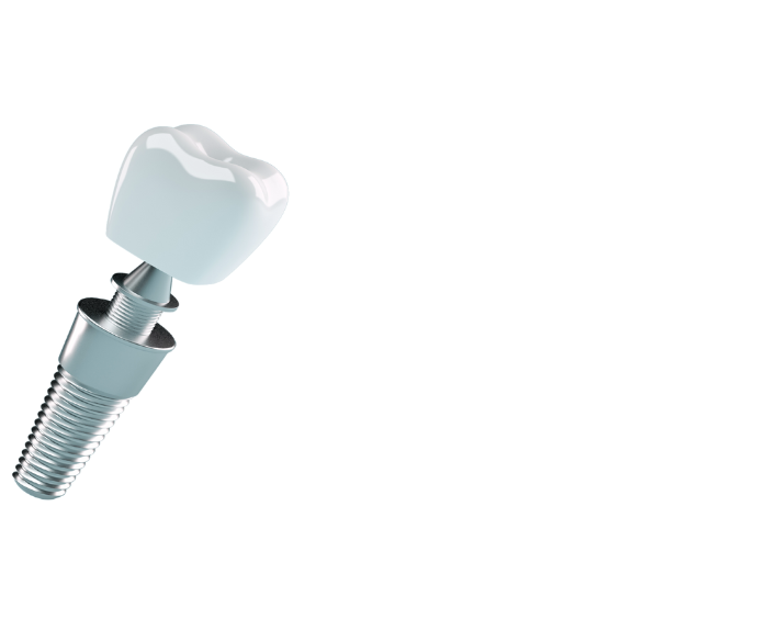 implante dental 3d