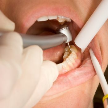 revision dentista conservadora pinar de chamartin